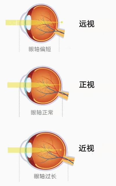 c8ad6ab352e531529aeec358db8fe458.png